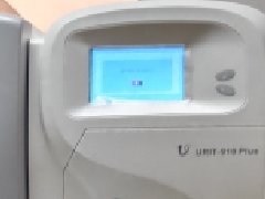 电解质分析仪